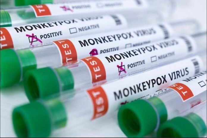 Monkeypox: Dubai authority declares isolation rules for confirmed cases